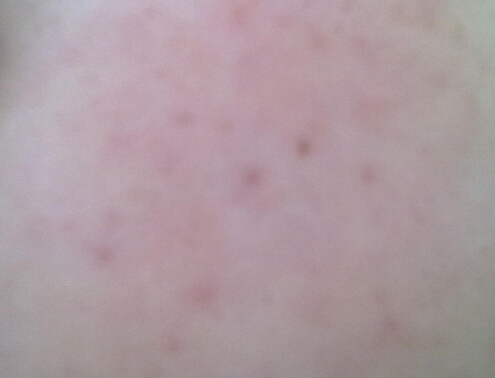 Ƥ������