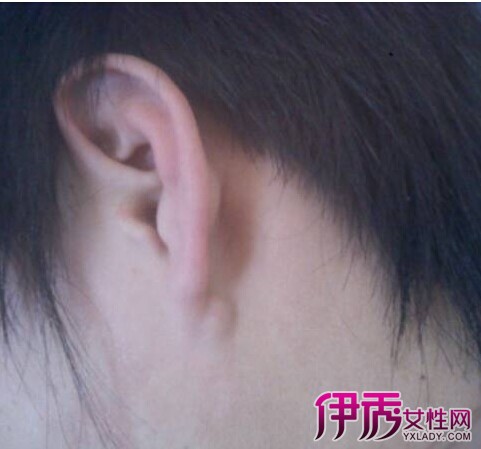 ������泤�˸�Ӳ��