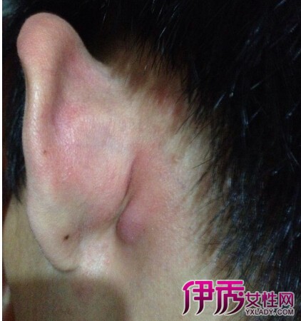 ������泤�˸�Ӳ��