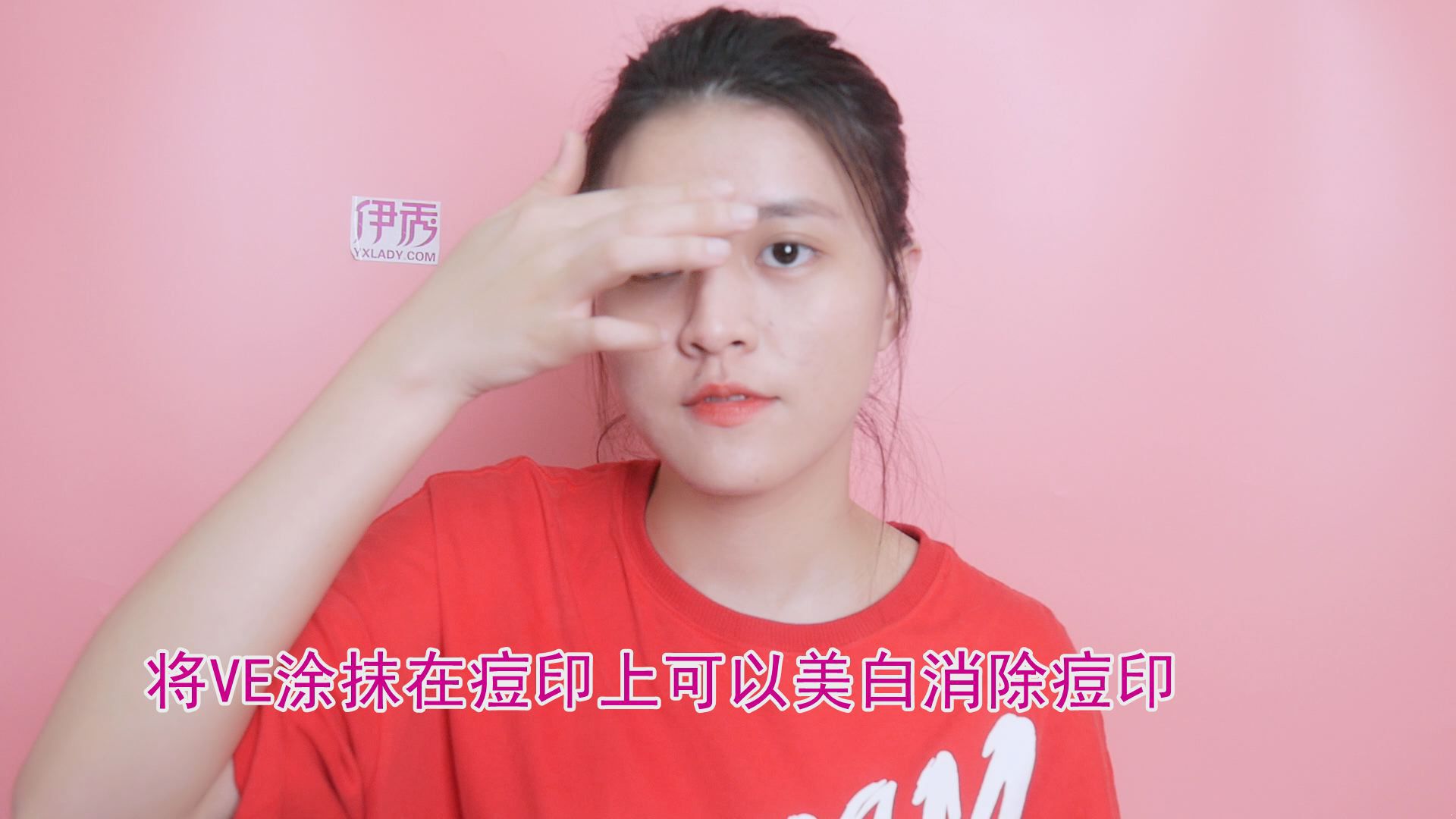 痘印如何去除 这三种方法可以帮到你 痘印如何去除|如何去除痘印|痘印怎么去掉|